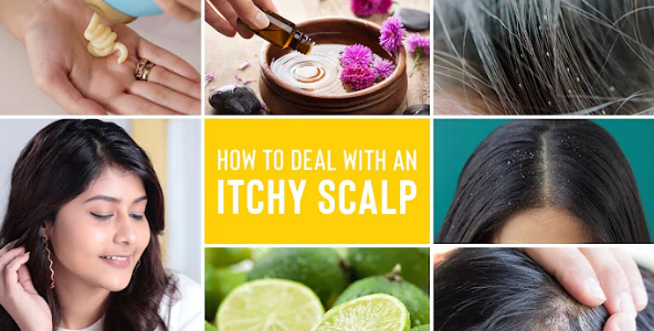 Itchy Scalp In Summer