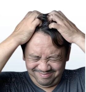 Itchy Scalp In SUMMER