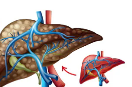 Liver Disease