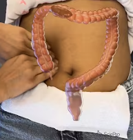 Bloating 