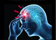 Migraine