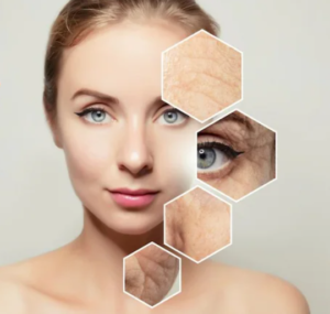 Collagen