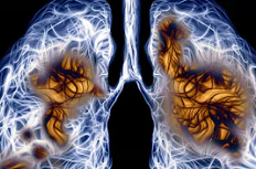 Lung Cancer